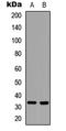 Caspase 6 antibody, LS-C354580, Lifespan Biosciences, Western Blot image 