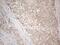 Insulin Like Growth Factor Binding Protein 1 antibody, NBP2-46039, Novus Biologicals, Immunohistochemistry paraffin image 