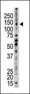 Ubiquitination Factor E4B antibody, PA5-11956, Invitrogen Antibodies, Western Blot image 