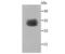 Sarcoglycan Gamma antibody, A05934, Boster Biological Technology, Western Blot image 