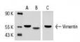 Vimentin antibody, sc-6260, Santa Cruz Biotechnology, Western Blot image 