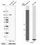CAP-Gly Domain Containing Linker Protein 2 antibody, NBP1-85569, Novus Biologicals, Western Blot image 