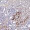 Pre-MRNA Processing Factor 38A antibody, NBP2-32385, Novus Biologicals, Immunohistochemistry paraffin image 