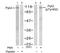 Protein Tyrosine Kinase 2 Beta antibody, GTX78958, GeneTex, Western Blot image 