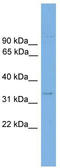 Ankyrin Repeat Domain 54 antibody, TA340311, Origene, Western Blot image 