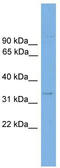 LIAR antibody, TA340311, Origene, Western Blot image 