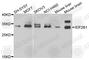 Eukaryotic Translation Initiation Factor 2B Subunit Alpha antibody, A7892, ABclonal Technology, Western Blot image 