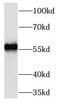 Transmembrane Protein 161A antibody, FNab08755, FineTest, Western Blot image 