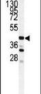 Cathepsin S antibody, PA5-14271, Invitrogen Antibodies, Western Blot image 