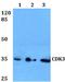 Cyclin Dependent Kinase 3 antibody, A08097, Boster Biological Technology, Western Blot image 