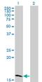 Zinc Finger Protein 44 antibody, MA5-21976, Invitrogen Antibodies, Western Blot image 