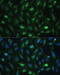 Casein Kinase 2 Beta antibody, 15-684, ProSci, Immunofluorescence image 