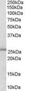 Glutathione S-Transferase Mu 1 antibody, MBS420063, MyBioSource, Western Blot image 