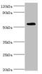 tRNA-splicing endonuclease subunit Sen2 antibody, LS-C676654, Lifespan Biosciences, Western Blot image 