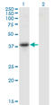 Serpin Family B Member 10 antibody, LS-C197899, Lifespan Biosciences, Western Blot image 
