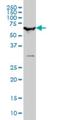 SWI/SNF Related, Matrix Associated, Actin Dependent Regulator Of Chromatin, Subfamily D, Member 2 antibody, H00006603-M01, Novus Biologicals, Western Blot image 