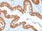 Villin 1 antibody, GTX02739, GeneTex, Immunohistochemistry paraffin image 