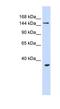 Ubiquitin Protein Ligase E3B antibody, NBP1-54950, Novus Biologicals, Western Blot image 