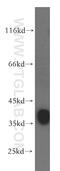 G Protein Subunit Alpha I2 antibody, 11136-1-AP, Proteintech Group, Western Blot image 