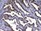 Calpain 2 antibody, A03492, Boster Biological Technology, Immunohistochemistry paraffin image 