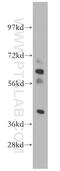 Trans-1,2-dihydrobenzene-1,2-diol dehydrogenase antibody, 13900-1-AP, Proteintech Group, Western Blot image 