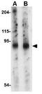 SLIT And NTRK Like Family Member 6 antibody, GTX85411, GeneTex, Western Blot image 