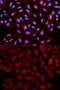 Proteasome Activator Subunit 3 antibody, GTX32822, GeneTex, Immunofluorescence image 