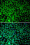 Ring-Box 1 antibody, STJ25318, St John