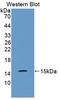 S100 Calcium Binding Protein A9 antibody, LS-C375095, Lifespan Biosciences, Western Blot image 