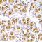 Potassium Calcium-Activated Channel Subfamily N Member 3 antibody, LS-C335638, Lifespan Biosciences, Immunohistochemistry paraffin image 