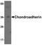 Chondroadherin antibody, A03177, Boster Biological Technology, Western Blot image 