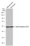 Tubulin Beta 3 Class III antibody, GTX130245, GeneTex, Western Blot image 