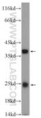 TMEM9 Domain Family Member B antibody, 24331-1-AP, Proteintech Group, Western Blot image 