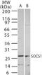 Suppressor Of Cytokine Signaling 1 antibody, PA1-41009, Invitrogen Antibodies, Western Blot image 