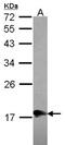 Molybdenum Cofactor Synthesis 2 antibody, NBP2-17319, Novus Biologicals, Western Blot image 