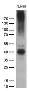 ATP Binding Cassette Subfamily C Member 2 antibody, M00974-1, Boster Biological Technology, Western Blot image 