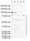 Cartilage Oligomeric Matrix Protein antibody, ab74524, Abcam, Western Blot image 