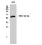 Protein Kinase CAMP-Dependent Type II Regulatory Subunit Alpha antibody, STJ95109, St John