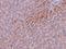 TBK1 Binding Protein 1 antibody, A10984, Boster Biological Technology, Immunohistochemistry frozen image 