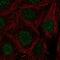 LIM Homeobox Transcription Factor 1 Beta antibody, NBP2-58009, Novus Biologicals, Immunocytochemistry image 