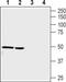 Cholinergic Receptor Nicotinic Alpha 9 Subunit antibody, PA5-77511, Invitrogen Antibodies, Western Blot image 