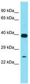 ATP23 Metallopeptidase And ATP Synthase Assembly Factor Homolog antibody, TA333586, Origene, Western Blot image 