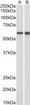 LCK Proto-Oncogene, Src Family Tyrosine Kinase antibody, LS-C154971, Lifespan Biosciences, Western Blot image 