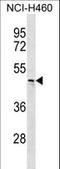 Carbohydrate Sulfotransferase 6 antibody, LS-C168764, Lifespan Biosciences, Western Blot image 