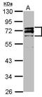 Lamin A/C antibody, GTX111677, GeneTex, Western Blot image 