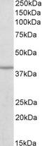 Isocitrate Dehydrogenase (NAD(+)) 3 Beta antibody, EB10998, Everest Biotech, Western Blot image 
