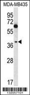 NFKB Inhibitor Like 1 antibody, 56-654, ProSci, Western Blot image 