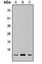 SPT4 Homolog, DSIF Elongation Factor Subunit antibody, orb304616, Biorbyt, Western Blot image 