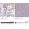 Nuclear Cap Binding Protein Subunit 1 antibody, NBP2-33897, Novus Biologicals, Immunohistochemistry paraffin image 