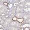 Fukutin Related Protein antibody, PA5-63857, Invitrogen Antibodies, Immunohistochemistry paraffin image 